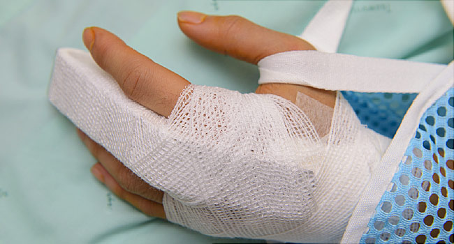 image of broken finger due to jammed finger catching a soccer ball